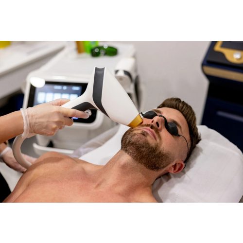 MEN'S laser facial hair removal - FULL FACE