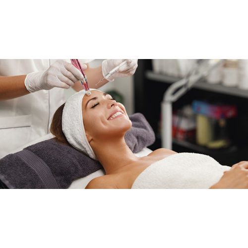 Microneedling kezelés