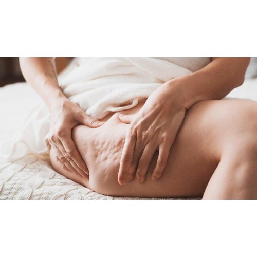 Cellulite Massage