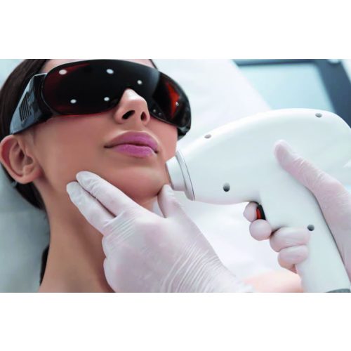 WOMEN'S LASER FACE HAIR REMOVAL - FULL FACE