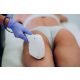 WOMEN'S LASER HAIR REMOVAL - LARGE BODY PART